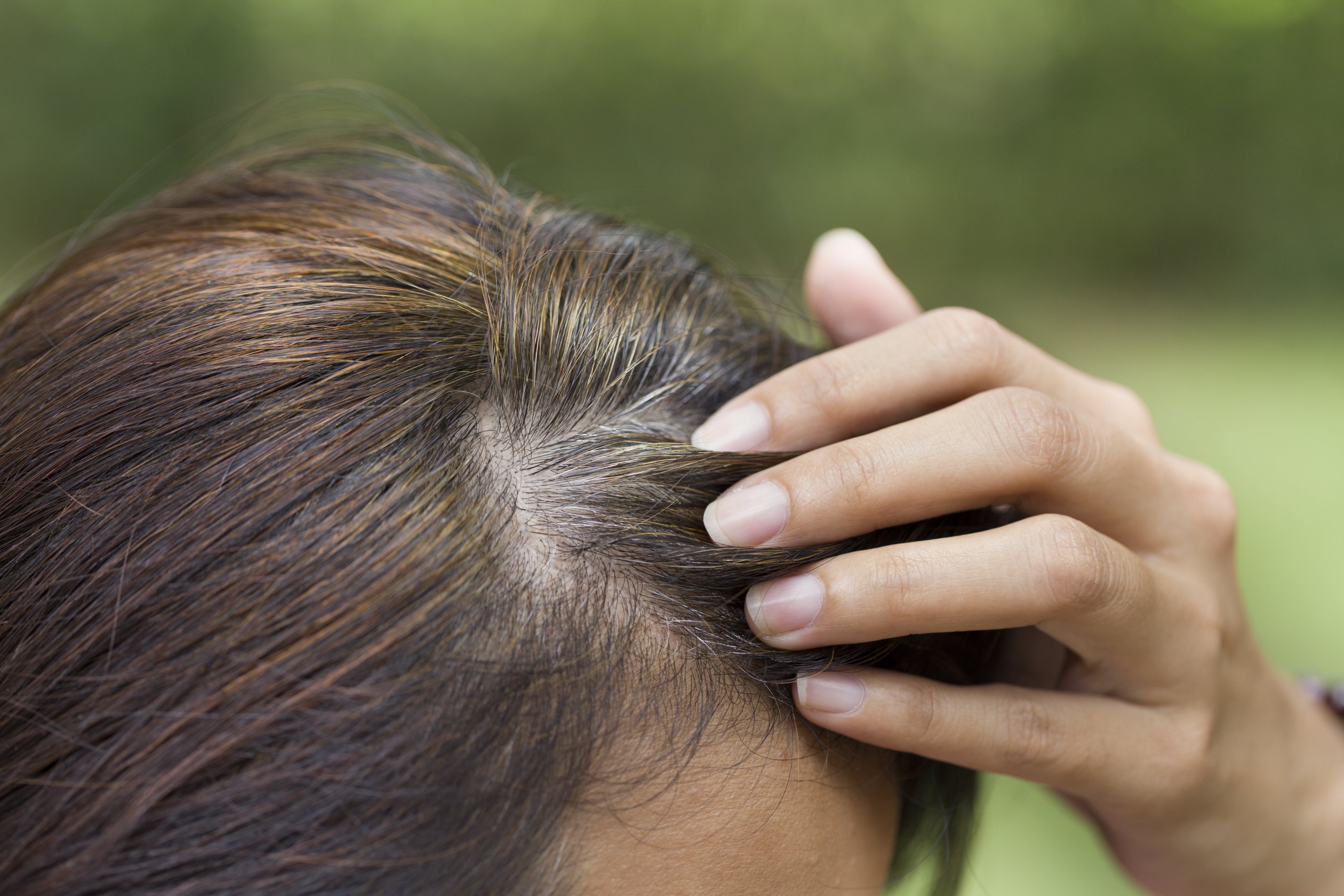 Op jonge leeftijd al grijze haren? Dit zegt het over